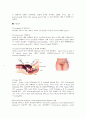 자궁_절제술(hystrectomy) 10페이지
