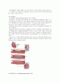 Myocardial Infarction(MI, 심근경색증) 8페이지