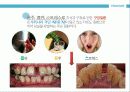 성인구강보건교육  4페이지