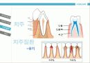 성인구강보건교육  14페이지