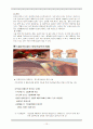 10A acute cholecytitis - case study 10페이지