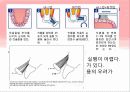 [예방치학] 올바른 칫솔질.ppt 11페이지