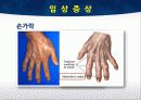 TKA ppt 17페이지