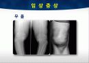 TKA ppt 18페이지