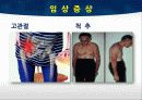 TKA ppt 19페이지