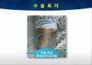 TKA ppt 31페이지