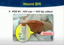 TKA ppt 45페이지
