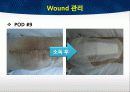 TKA ppt 46페이지