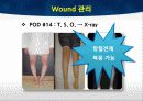 TKA ppt 47페이지
