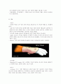 CTS : Carpal tunnel syndrome 수근관 증후군 5페이지