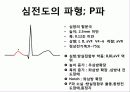 심전도 판독순서 5페이지