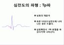 심전도 판독순서 6페이지