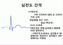 심전도 판독순서 12페이지