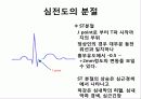 심전도 판독순서 14페이지
