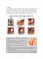 OR - myoma uteri LAVH,TAH 2페이지