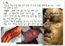 [A+] 월경주기와 배란 월경관련증상 임신의 과정 임신의 진단 분만 에이즈 임신증상 임신징후 분만과정 산욕기 유산 인공 임신중절의 문제 성병 매독 인공임신중절 37페이지