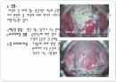 [A+] 월경주기와 배란 월경관련증상 임신의 과정 임신의 진단 분만 에이즈 임신증상 임신징후 분만과정 산욕기 유산 인공 임신중절의 문제 성병 매독 인공임신중절 38페이지