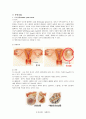 모성간호사례연구 - 난소낭종 (ovarian cystic tumor) 2페이지
