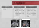 [A+] 뉴로마케팅 (Neuro Marketing) - 뉴로마케팅 정의와 개념, 성장배경, 주목받는 이유, 활용분야, 성공사례, 한계, 효과적인 활용방법, 기아자동차K7, 아이트래킹, 아모레퍼시픽.ppt 25페이지