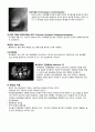케이스 스터디 - Lumbar herniated intervertebral disc (요추 추간판 탈출증) &  Biliary Pancreatitis (담즙 췌장염) & nonrheumatic mitral regurgitation (비 류마티스성 승모판막 폐쇄부전증) 22페이지