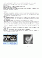 케이스 스터디 - Lumbar herniated intervertebral disc (요추 추간판 탈출증) &  Biliary Pancreatitis (담즙 췌장염) & nonrheumatic mitral regurgitation (비 류마티스성 승모판막 폐쇄부전증) 25페이지