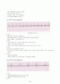 부정맥(arrhythmia) 및 치료 3페이지