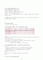 부정맥(arrhythmia) 및 치료 8페이지