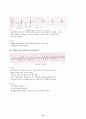 부정맥(arrhythmia) 및 치료 15페이지