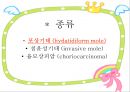 H-mole , 포상기태 .ppt 2페이지