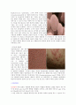 [미생물학실험] 구강, 피부로부터 정상상주균층의 분리 및 사면배양 실험 2페이지