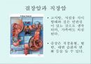 [A+] 암의 예방과 정복 - 암의 유병율, 양성종양, 악성종양, 암의원인, 전파경로, 경고신호, 암의 종류, 위험요인, 예방법, 치료법, 올바른식사법, 유방암직장암결장암백혈병.ppt 15페이지