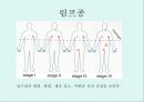 [A+] 암의 예방과 정복 - 암의 유병율, 양성종양, 악성종양, 암의원인, 전파경로, 경고신호, 암의 종류, 위험요인, 예방법, 치료법, 올바른식사법, 유방암직장암결장암백혈병.ppt 19페이지
