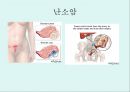 [A+] 암의 예방과 정복 - 암의 유병율, 양성종양, 악성종양, 암의원인, 전파경로, 경고신호, 암의 종류, 위험요인, 예방법, 치료법, 올바른식사법, 유방암직장암결장암백혈병.ppt 20페이지