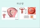 [A+] 암의 예방과 정복 - 암의 유병율, 양성종양, 악성종양, 암의원인, 전파경로, 경고신호, 암의 종류, 위험요인, 예방법, 치료법, 올바른식사법, 유방암직장암결장암백혈병.ppt 21페이지