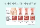 [A+] 암의 예방과 정복 - 암의 유병율, 양성종양, 악성종양, 암의원인, 전파경로, 경고신호, 암의 종류, 위험요인, 예방법, 치료법, 올바른식사법, 유방암직장암결장암백혈병.ppt 22페이지