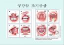 [A+] 암의 예방과 정복 - 암의 유병율, 양성종양, 악성종양, 암의원인, 전파경로, 경고신호, 암의 종류, 위험요인, 예방법, 치료법, 올바른식사법, 유방암직장암결장암백혈병.ppt 24페이지