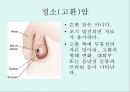[A+] 암의 예방과 정복 - 암의 유병율, 양성종양, 악성종양, 암의원인, 전파경로, 경고신호, 암의 종류, 위험요인, 예방법, 치료법, 올바른식사법, 유방암직장암결장암백혈병.ppt 26페이지