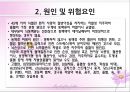 aneurysm PPT 4페이지