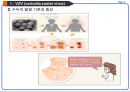 대상포진(Herpes zoster) Case study.ppt 7페이지