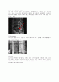 스포츠 선수의 요추간판 탈출증(Herniated Lumbar Disk) 해부학 및 손상,치료 ,재활 4페이지