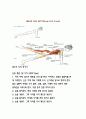 스포츠 선수의 전방전위증에 좋은 운동 및 금기 사항 6페이지