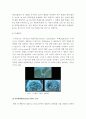1.면역에 관여하는 3가지 세포와 4가지 형태 과민반응의 특징 사례 2.악성종양 양성종양 차이 및 국소영향 전신영향 3.혈액응고과정 3단계와 DIC발생기전 DIC환자간호중재-면역세포 3가지- 5페이지