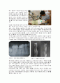 근관치료학 report 16페이지