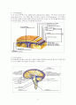 뇌동맥류(cerebral aneurysm)치료와 수술 후 간호 6페이지