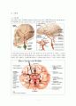 뇌동맥류(cerebral aneurysm)치료와 수술 후 간호 7페이지