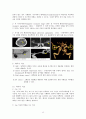 뇌동맥류(cerebral aneurysm)치료와 수술 후 간호 13페이지