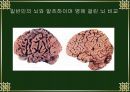 치매와 기능성 식품.PPT자료 13페이지