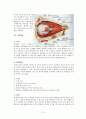 백내장수술(cataract extraction) 간호 10페이지