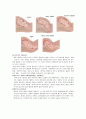 자연분만（NSFD) 6페이지