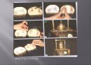 국소의치 - 레진(Resin)주입에서 연마(Polishing) 과정.ppt 8페이지